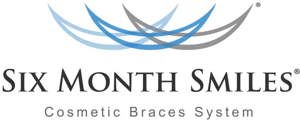 carlsbad shores dentistry six month smiles cosmetic braces system